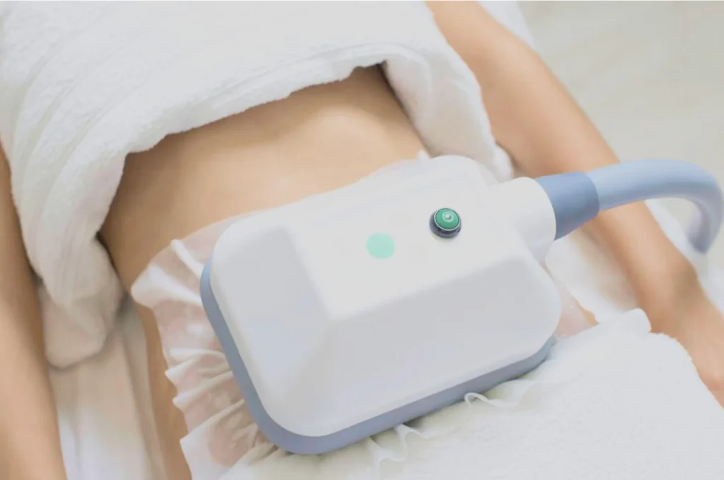 How Fat Freezing and HIFU Work Together? 3 advantages to combining Fat Freezing and HIFU Hertfordshire