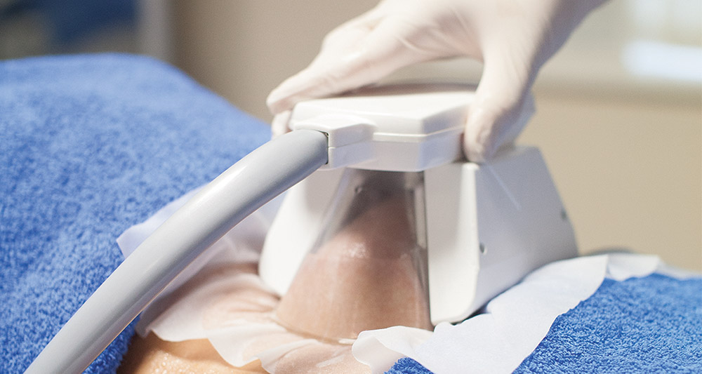How Fat Freezing and HIFU Work Together? 2 Multiple Areas in One Session HIFU and Fat Freezing Hertfordshire