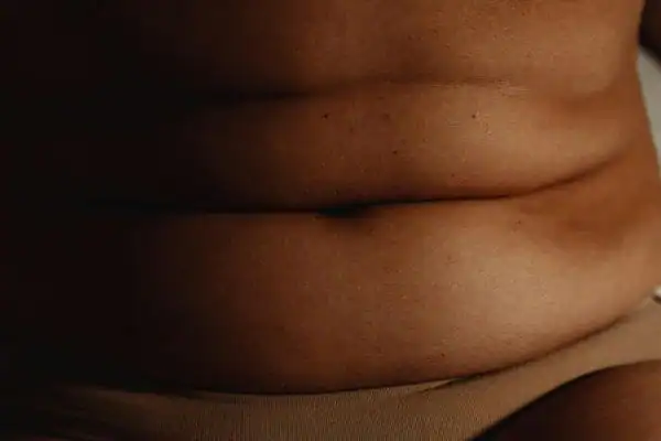 The Hidden Connection: How Stress Shapes Your Fitness and Body Composition 3 image of what stress can do on the stomach area and how Lipo 360 Hertfordshire can help to change your body shape.